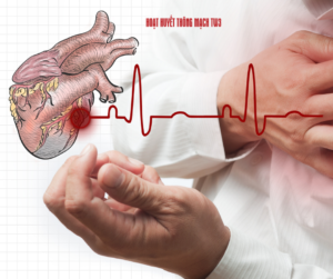 Những người bị một số bệnh lý về tim mạch thường có nguy cơ đột quỵ rất cao
